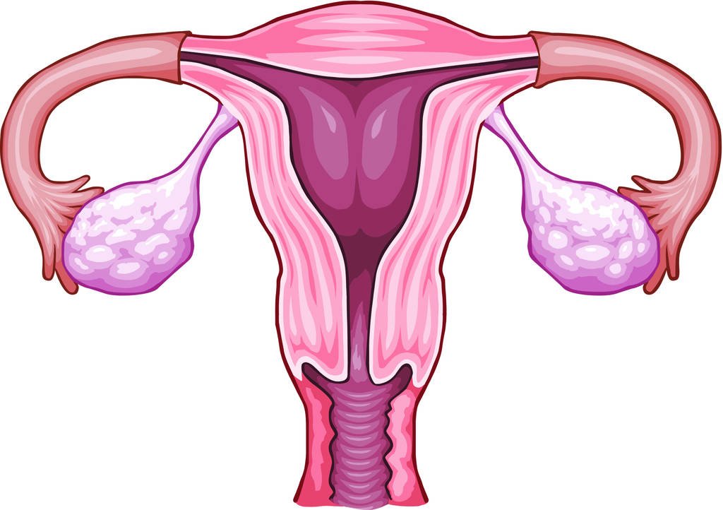 ovarian cancer